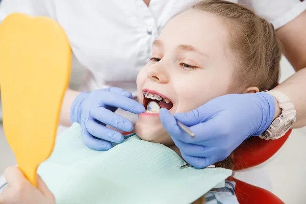 Benefits Of Early Intervention In Tooth Extractions