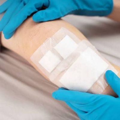 Benefits of Receiving Prompt Wound Care