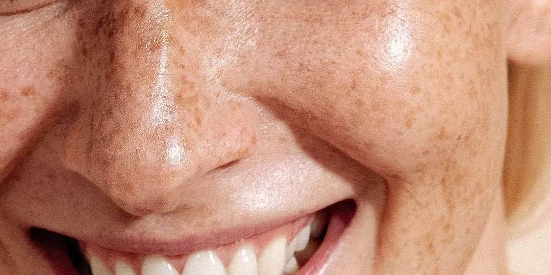 Softening Lines and Wrinkles