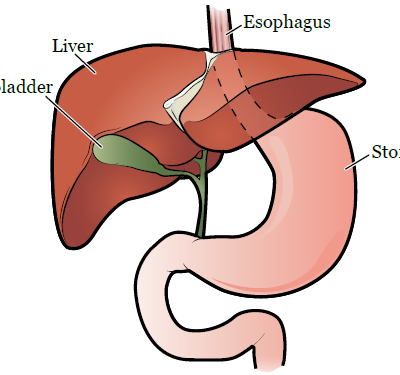 Understanding Gallbladder Disease and When Surgery Is Necessary