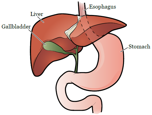 Understanding Gallbladder Disease and When Surgery Is Necessary