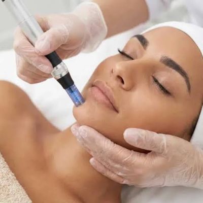 What to Expect During Your first Microneedling Appointment