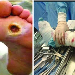 Innovative Approaches in Wound Care