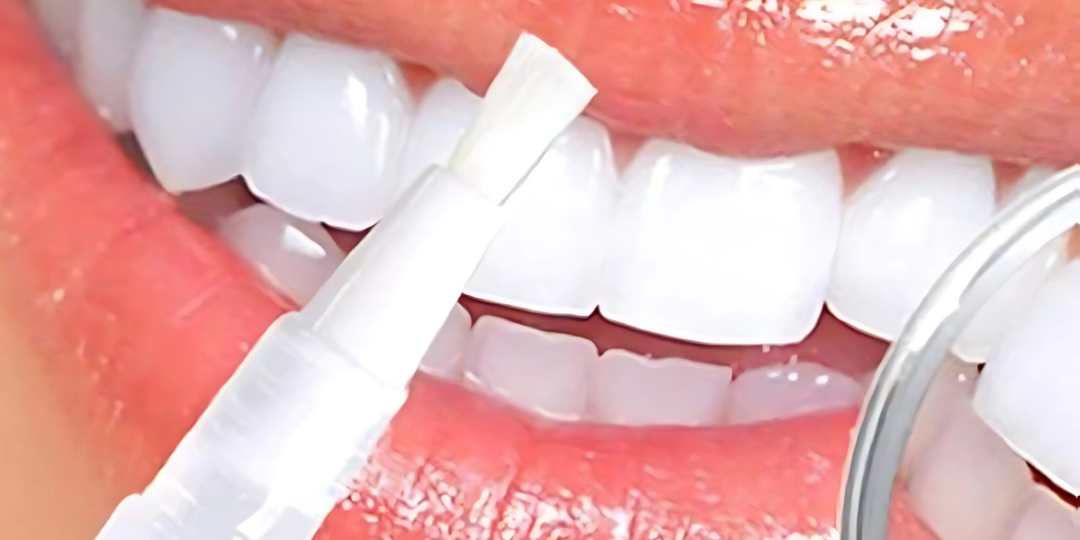 The Best Teeth Whitening Tips and Tricks