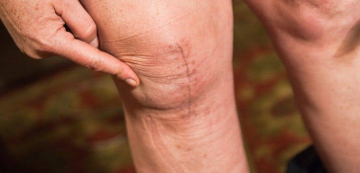 Understanding the Different Types of Arthritis and Their Impact on Daily Life