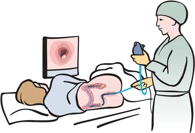 The Benefits of Pre-Colonoscopy Preparation