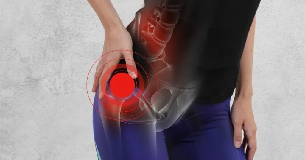 What To Know About Treatment From Sciatica Specialists